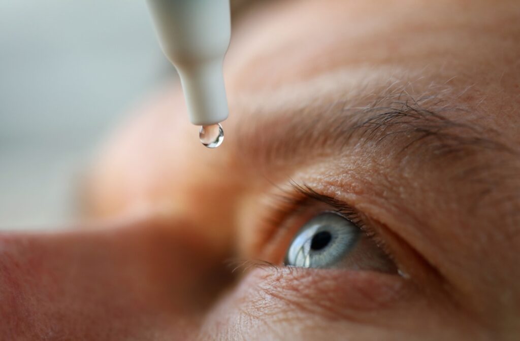 Close-up of eye dropper about to put a lubricating eye drop onto an irritated eye.